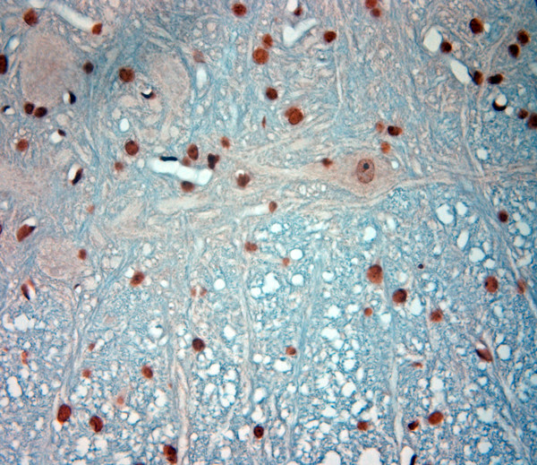 c Fos Antibody in Immunohistochemistry (Paraffin) (IHC (P))