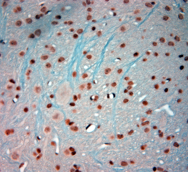 c Fos Antibody in Immunohistochemistry (Paraffin) (IHC (P))