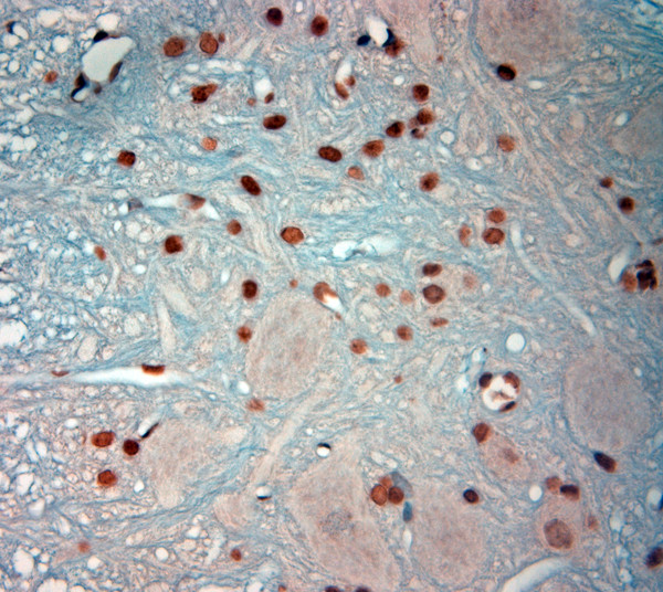 c Fos Antibody in Immunohistochemistry (Paraffin) (IHC (P))