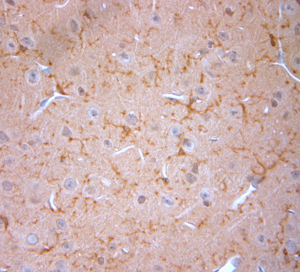 Cofilin 1 Antibody in Immunohistochemistry (Paraffin) (IHC (P))