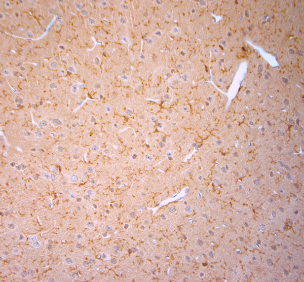 Cofilin 1 Antibody in Immunohistochemistry (Paraffin) (IHC (P))