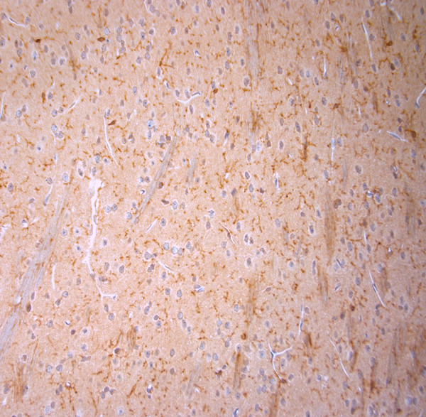 Cofilin 1 Antibody in Immunohistochemistry (Paraffin) (IHC (P))