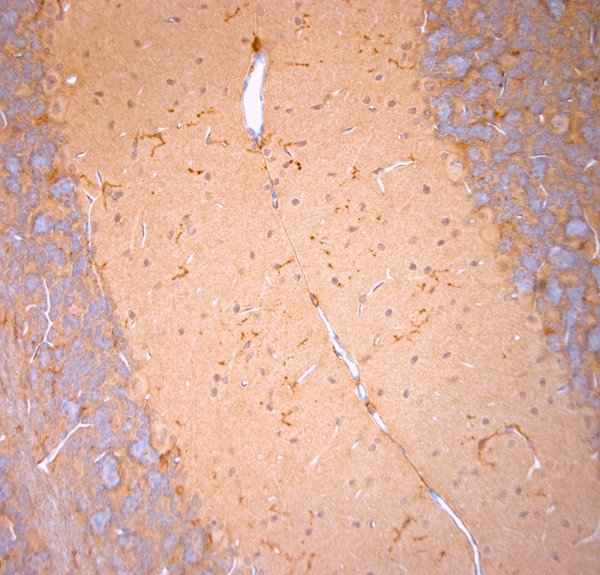 Cofilin 1 Antibody in Immunohistochemistry (Paraffin) (IHC (P))