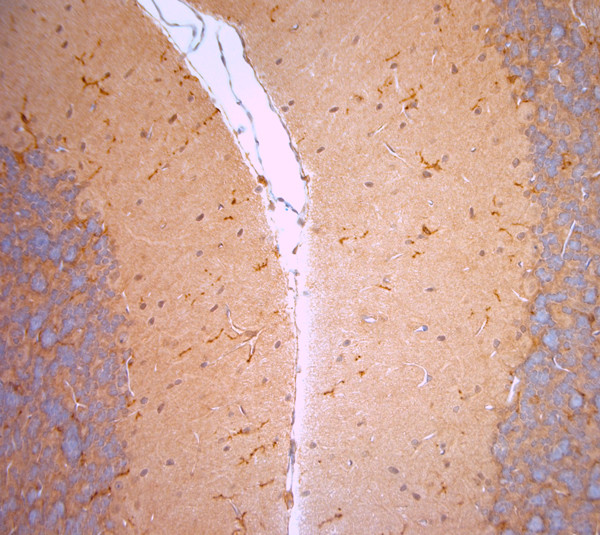 Cofilin 1 Antibody in Immunohistochemistry (Paraffin) (IHC (P))