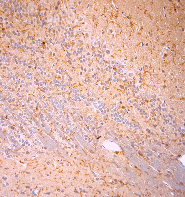 Cofilin 1 Antibody in Immunohistochemistry (Paraffin) (IHC (P))