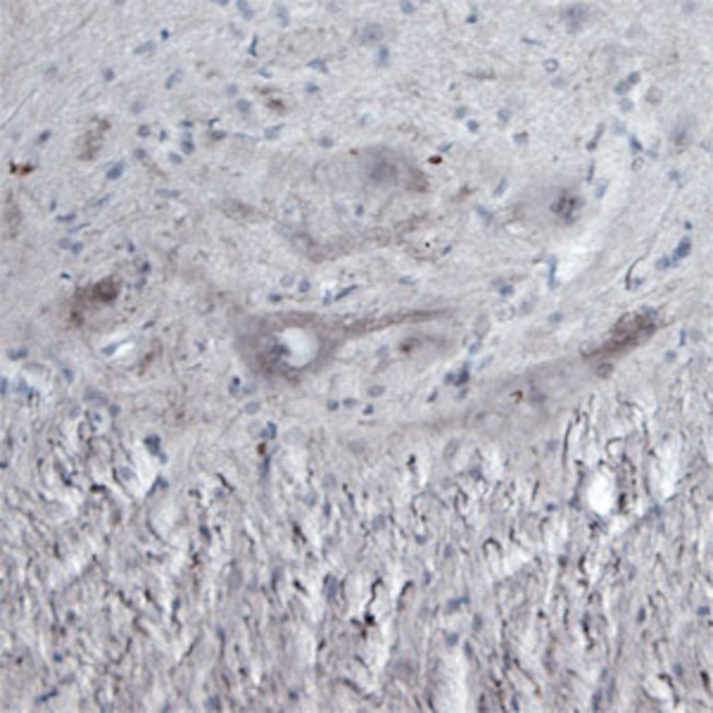 CACNA1I Antibody in Immunohistochemistry - Free Floating (IHC (Free))