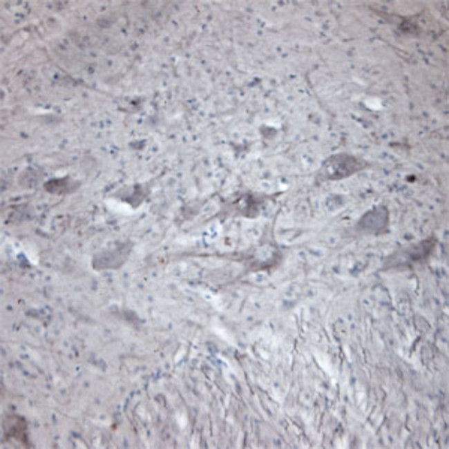 CACNA1I Antibody in Immunohistochemistry - Free Floating (IHC (Free))