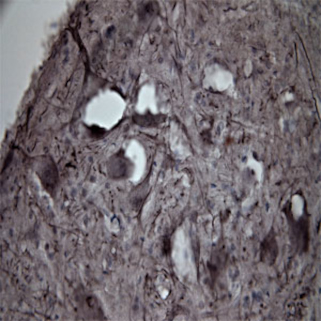 CACNA1I Antibody in Immunohistochemistry - Free Floating (IHC (Free))