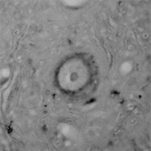 CACNA1I Antibody in Immunohistochemistry (Paraffin) (IHC (P))