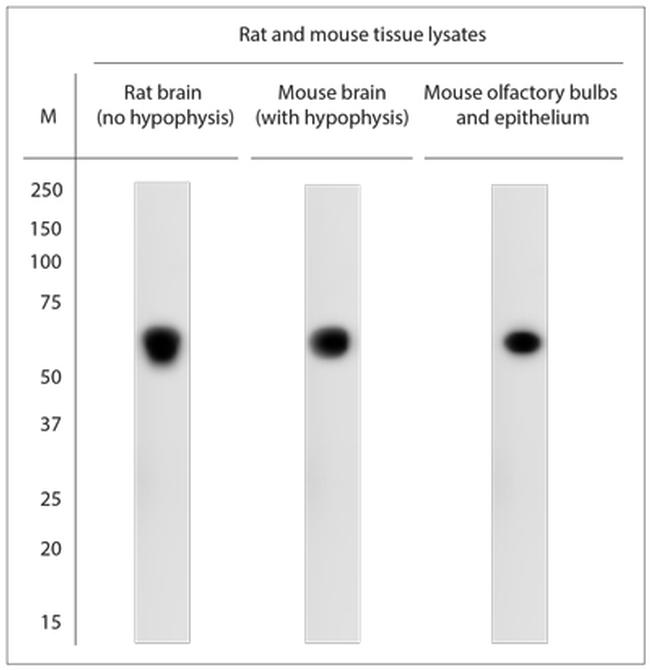 CACNB4 Antibody in Western Blot (WB)