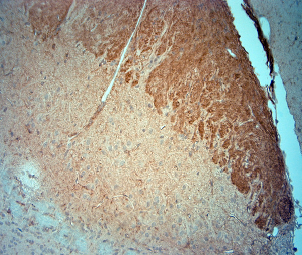 CACNA2D3 Antibody in Immunohistochemistry (Paraffin) (IHC (P))