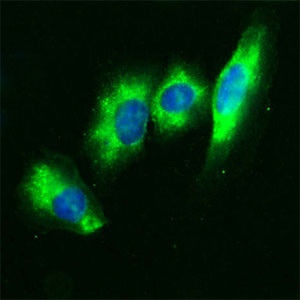 CD36 Antibody in Immunocytochemistry (ICC/IF)