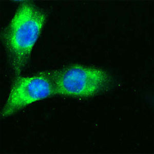 CD36 Antibody in Immunocytochemistry (ICC/IF)