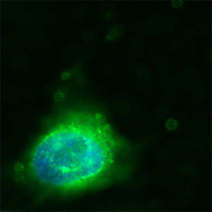 CD36 Antibody in Immunocytochemistry (ICC/IF)