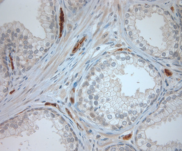 CLCN6 Antibody in Immunohistochemistry (Paraffin) (IHC (P))