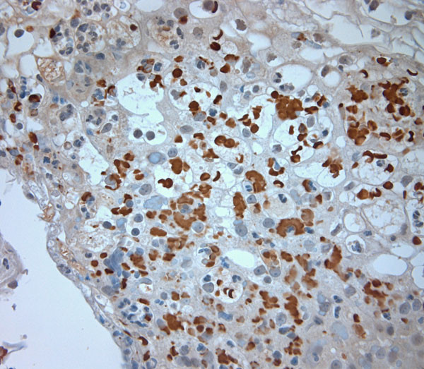 CLCN6 Antibody in Immunohistochemistry (Paraffin) (IHC (P))