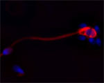 Cathelicidin Antibody in Immunocytochemistry (ICC/IF)