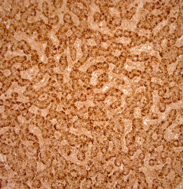 Catalase Antibody in Immunohistochemistry (Paraffin) (IHC (P))