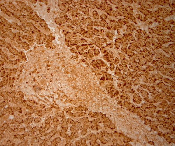 Catalase Antibody in Immunohistochemistry (Paraffin) (IHC (P))