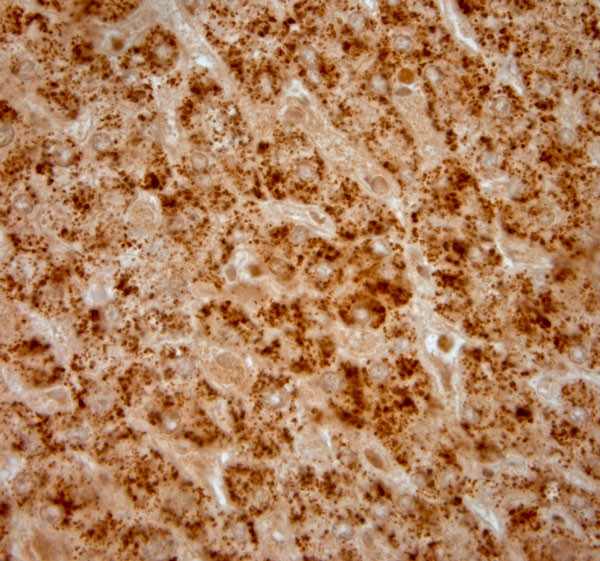 Catalase Antibody in Immunohistochemistry (Paraffin) (IHC (P))