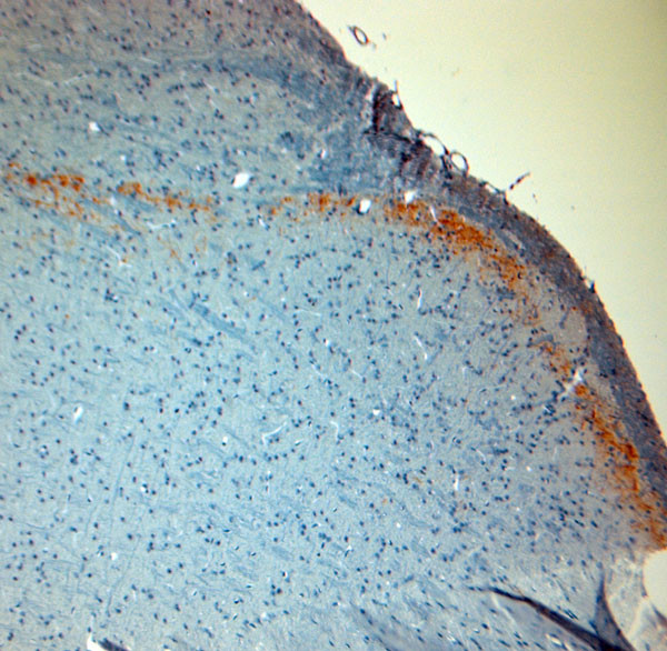 CGRP Antibody in Immunohistochemistry (Paraffin) (IHC (P))