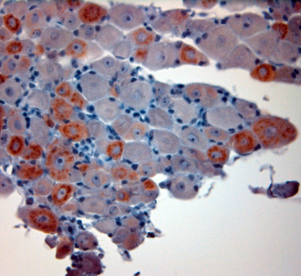 CGRP Antibody in Immunohistochemistry (Paraffin) (IHC (P))