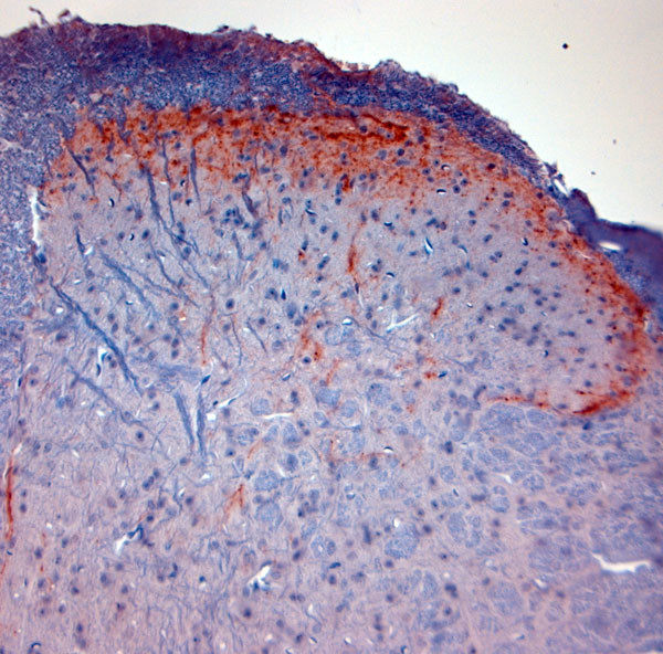 CGRP Antibody in Immunohistochemistry (Paraffin) (IHC (P))