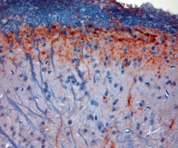 CGRP Antibody in Immunohistochemistry (Paraffin) (IHC (P))