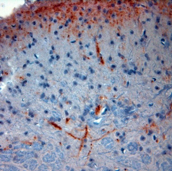 CGRP Antibody in Immunohistochemistry (Paraffin) (IHC (P))