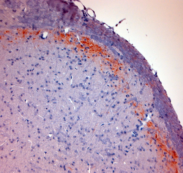 CGRP Antibody in Immunohistochemistry (Paraffin) (IHC (P))