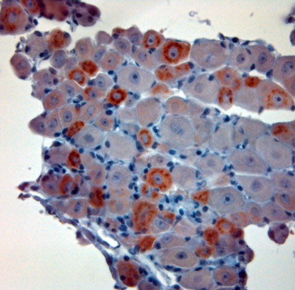 CGRP Antibody in Immunohistochemistry (Paraffin) (IHC (P))