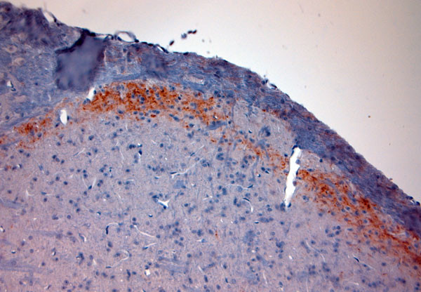 CGRP Antibody in Immunohistochemistry (Paraffin) (IHC (P))