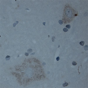CNTNAP2 Antibody in Immunohistochemistry (Paraffin) (IHC (P))