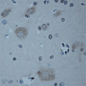 CNTNAP2 Antibody in Immunohistochemistry (Paraffin) (IHC (P))