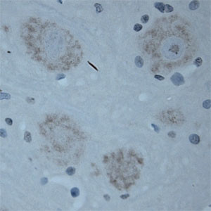 CNTNAP2 Antibody in Immunohistochemistry (Paraffin) (IHC (P))