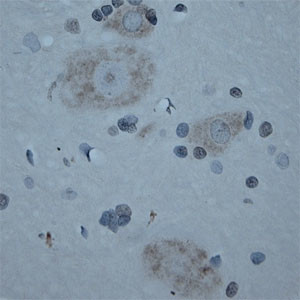 CNTNAP2 Antibody in Immunohistochemistry (Paraffin) (IHC (P))