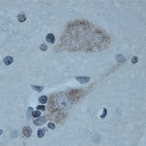 CNTNAP2 Antibody in Immunohistochemistry (Paraffin) (IHC (P))