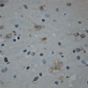 Cullin 5 Antibody in Immunohistochemistry (Paraffin) (IHC (P))