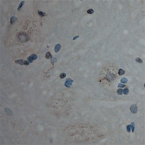 Cullin 5 Antibody in Immunohistochemistry (Paraffin) (IHC (P))