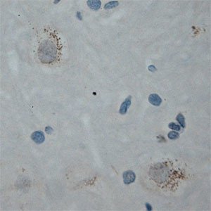 Cullin 5 Antibody in Immunohistochemistry (Paraffin) (IHC (P))