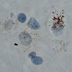 Cullin 5 Antibody in Immunohistochemistry (Paraffin) (IHC (P))