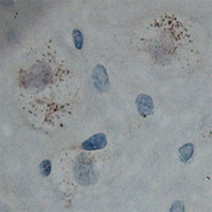 Cullin 5 Antibody in Immunohistochemistry (Paraffin) (IHC (P))