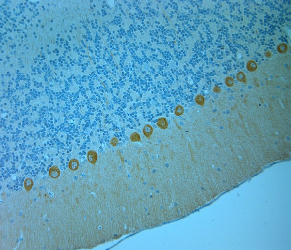 CALB1 Antibody in Immunohistochemistry (Paraffin) (IHC (P))