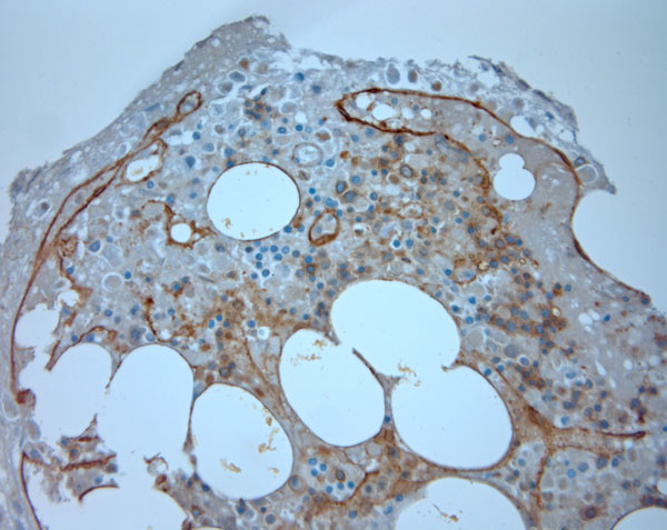 CD36 Antibody in Immunohistochemistry (Paraffin) (IHC (P))