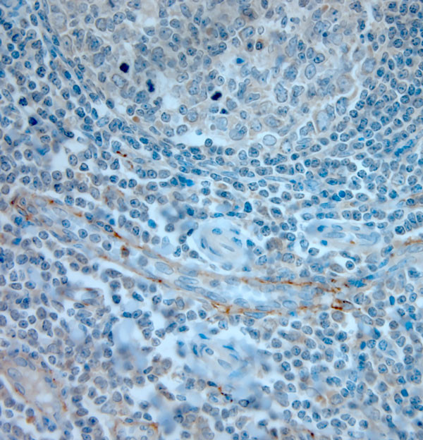 CD36 Antibody in Immunohistochemistry (Paraffin) (IHC (P))