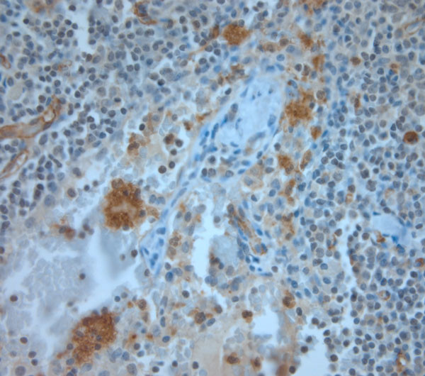 CD36 Antibody in Immunohistochemistry (Paraffin) (IHC (P))