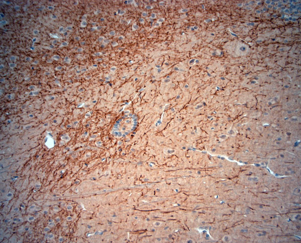 CLCN5 Antibody in Immunohistochemistry (Paraffin) (IHC (P))