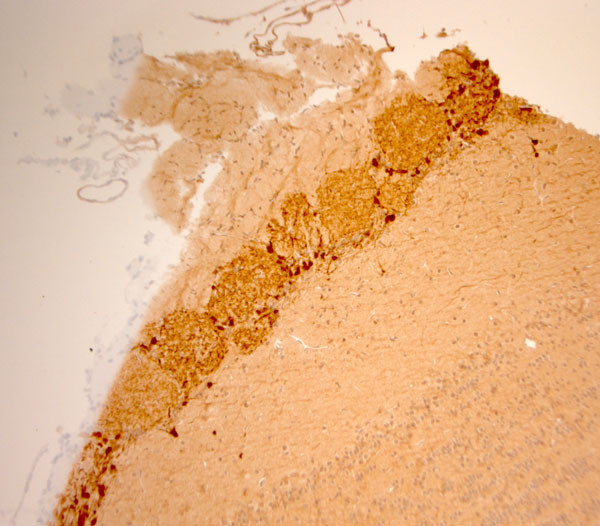 CLCN5 Antibody in Immunohistochemistry (Paraffin) (IHC (P))