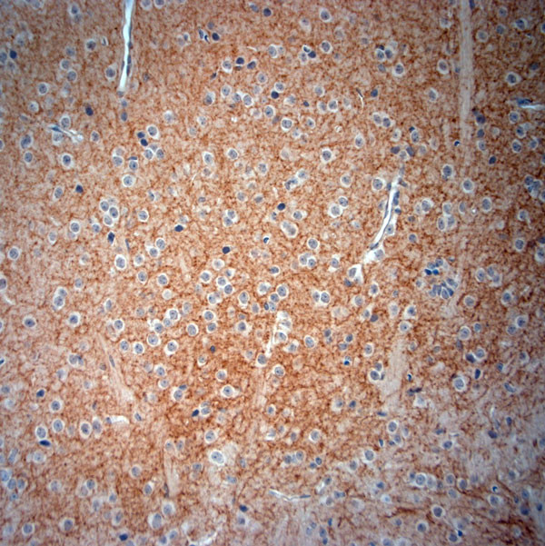 CLCN5 Antibody in Immunohistochemistry (Paraffin) (IHC (P))