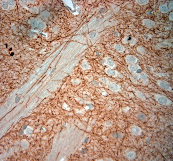 CLCN5 Antibody in Immunohistochemistry (Paraffin) (IHC (P))